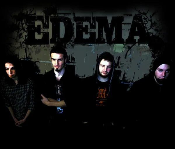 Edema