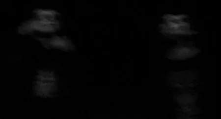 Black Bile