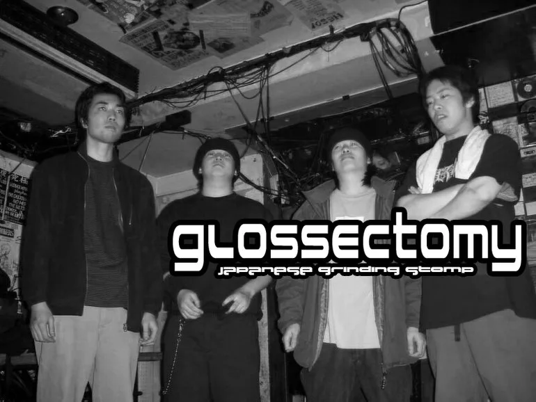 Glossectomy