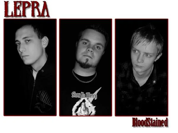 Lepra