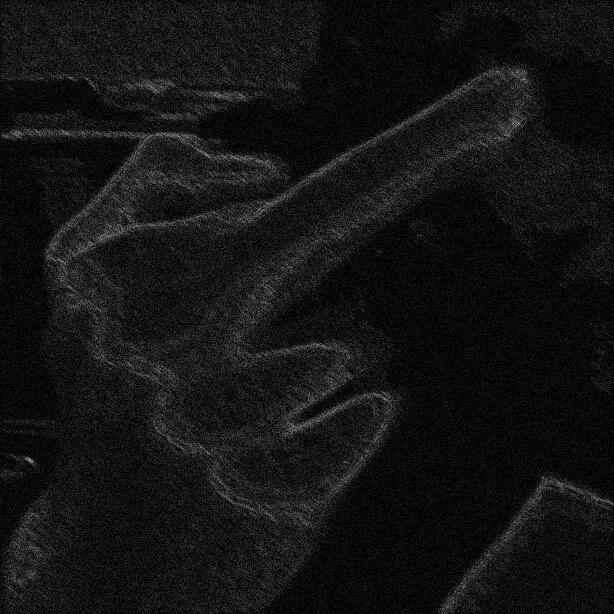 Kyphosis