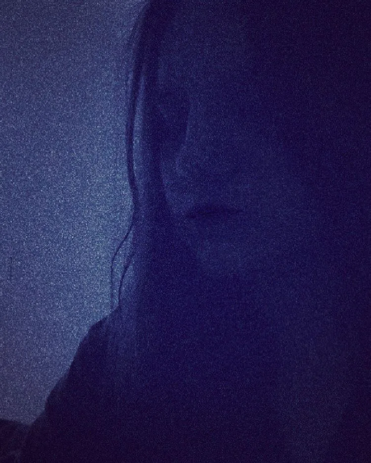 Lacrimal
