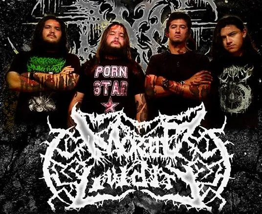 Morbid Lividity