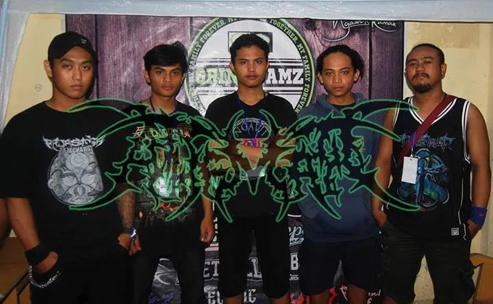 band