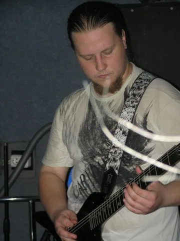 Prosopagnosia