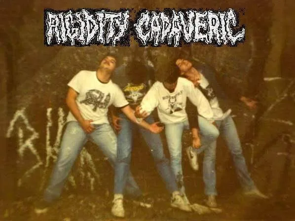 Rigidity Cadaveric