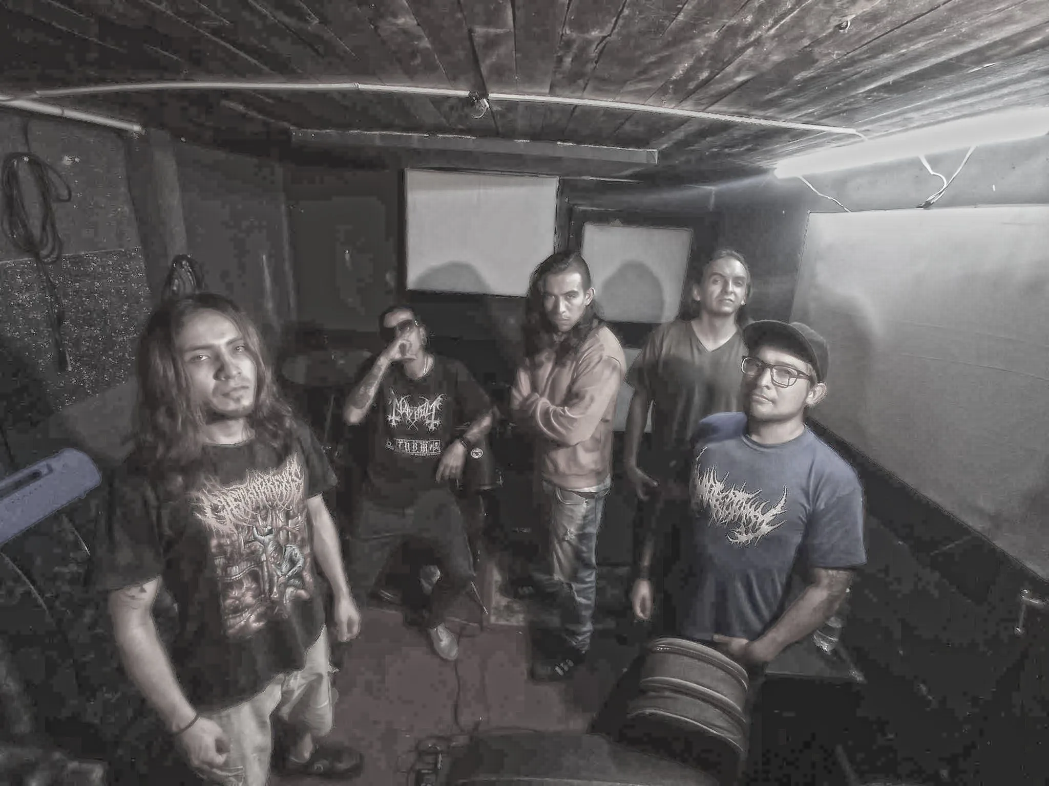 Scaphocephaly