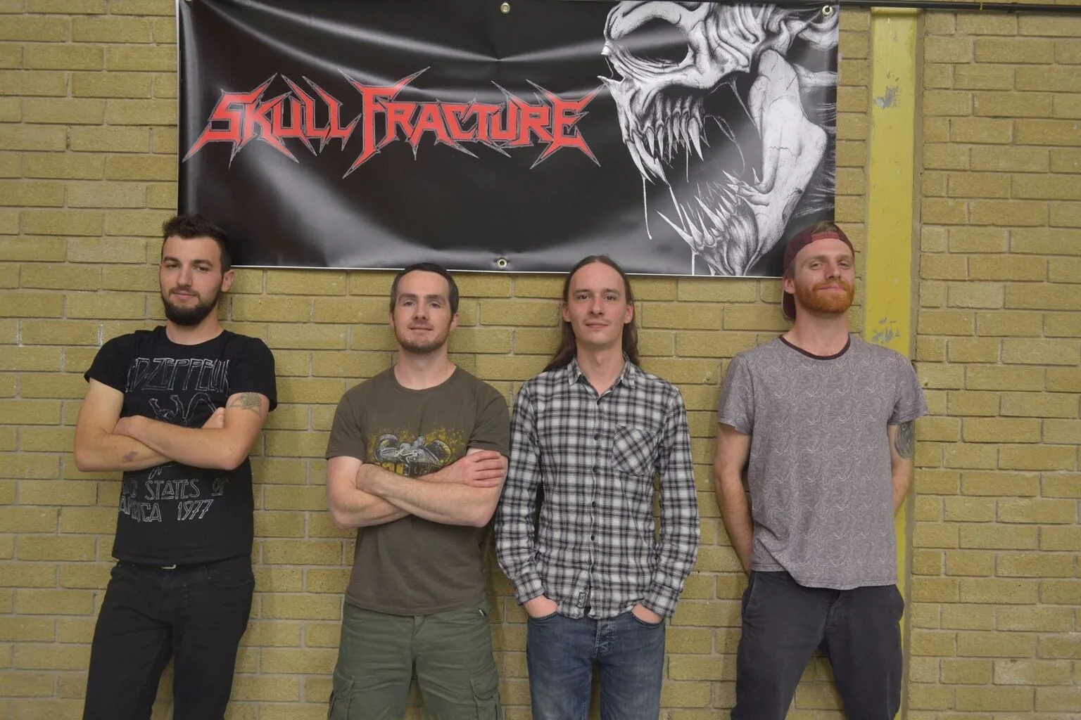 Skull Fracture