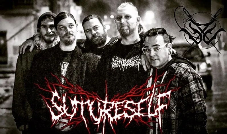 Suture-Self