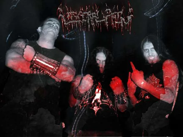 Visceral Pain