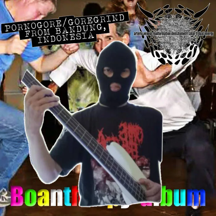 band