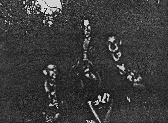 band