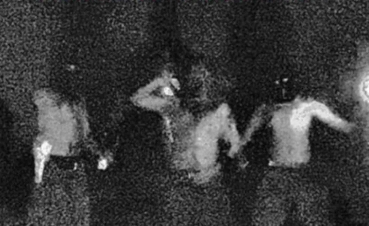 band