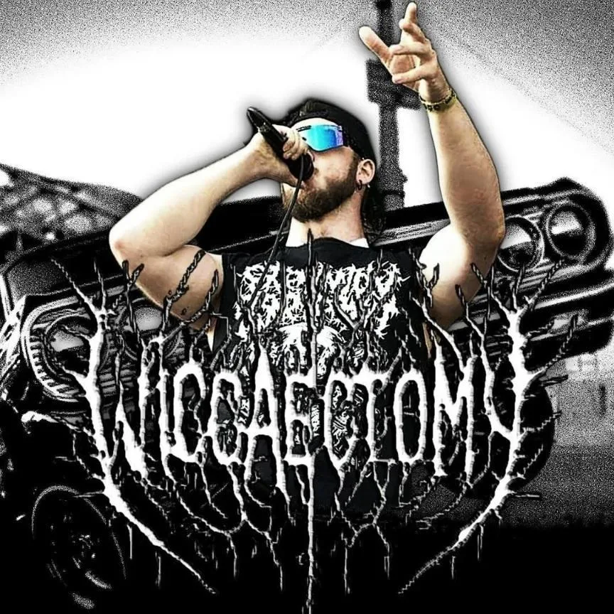 Wiggaectomy