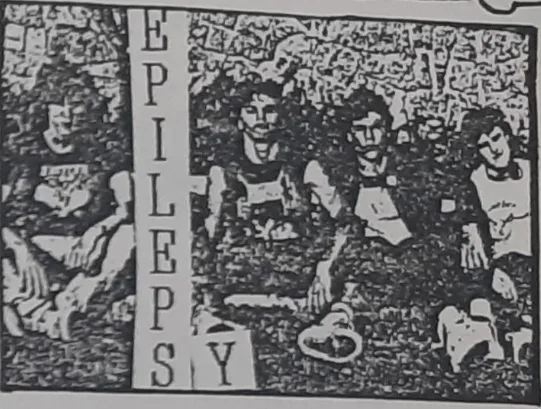 Epilepsy