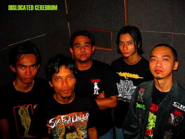 Dislocated Cerebrum