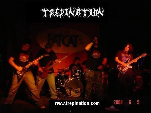 Trepination