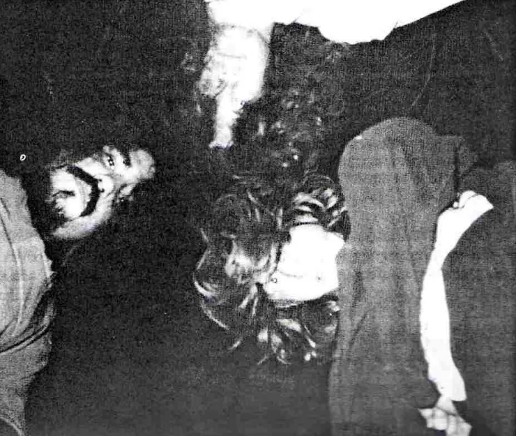 Emphysema