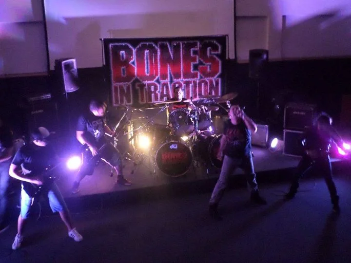 Bones in Traction