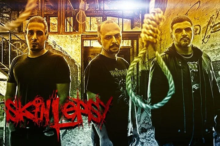 Skinlepsy