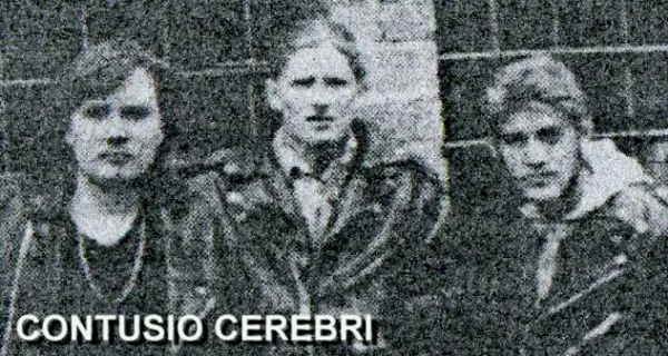Contusio Cerebri