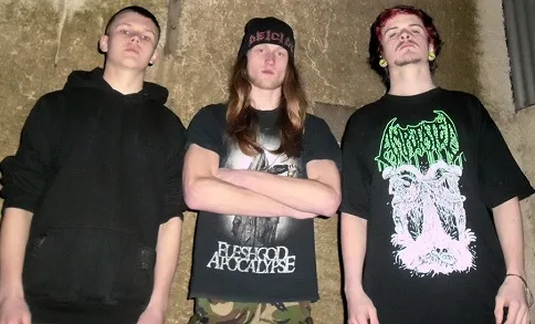 Cranioectomy